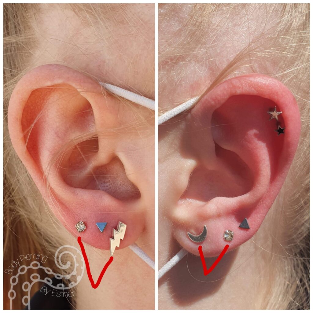 Medical Grade Plastic Earring -  UK